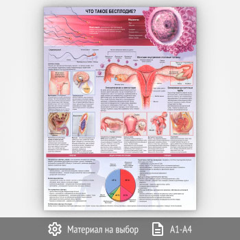 ������ ���� ����� ���������?� (���-45, 1 ����)